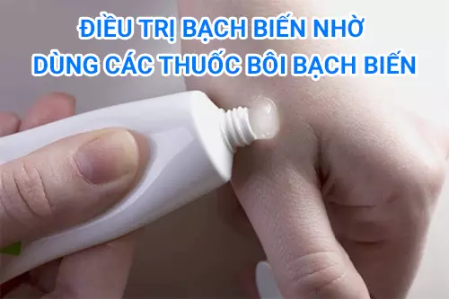 Thuoc-boi-corticosteroid-tri-bach-bien-cho-hieu-qua-cao.webp